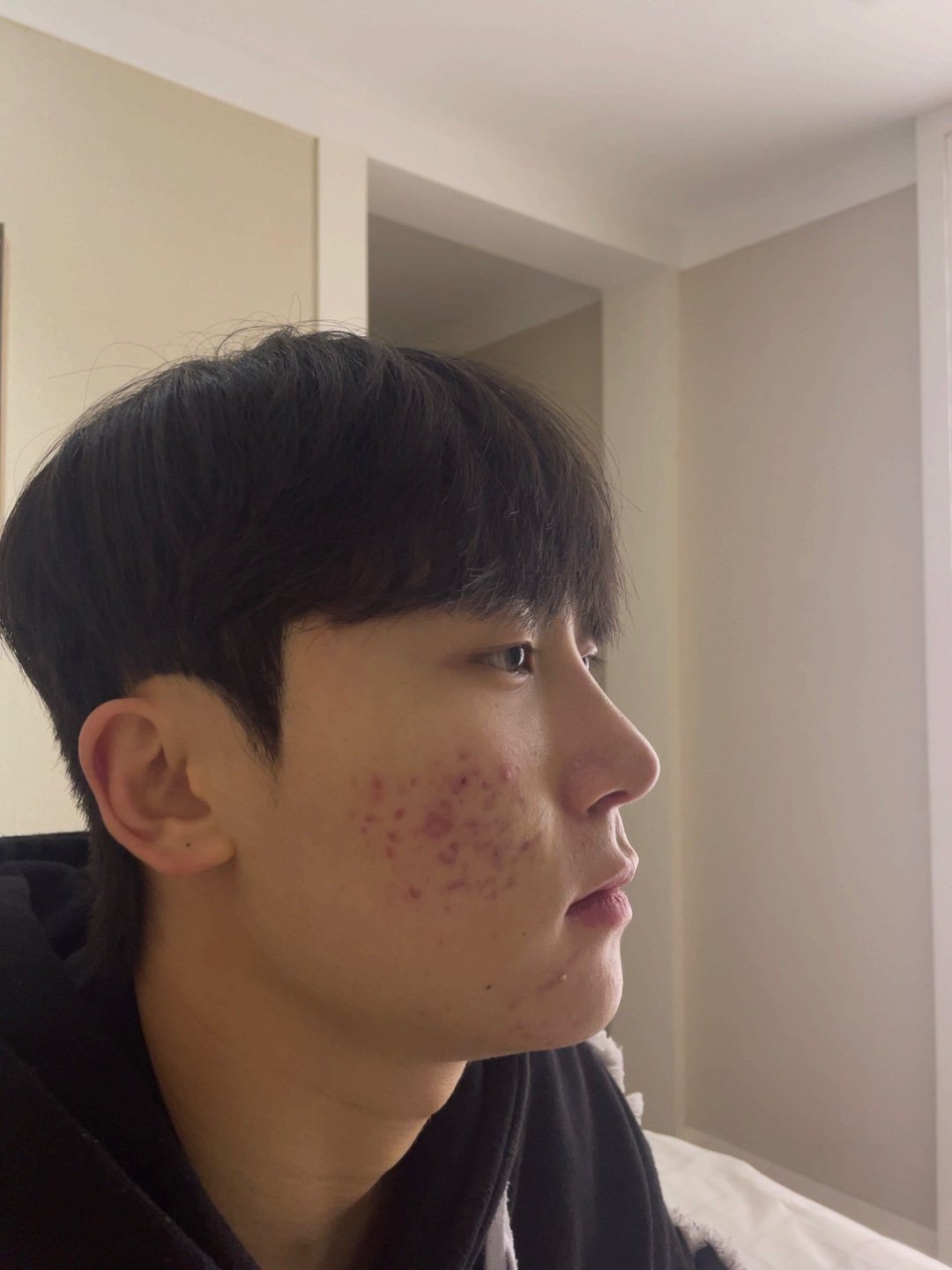 수술후기이미지