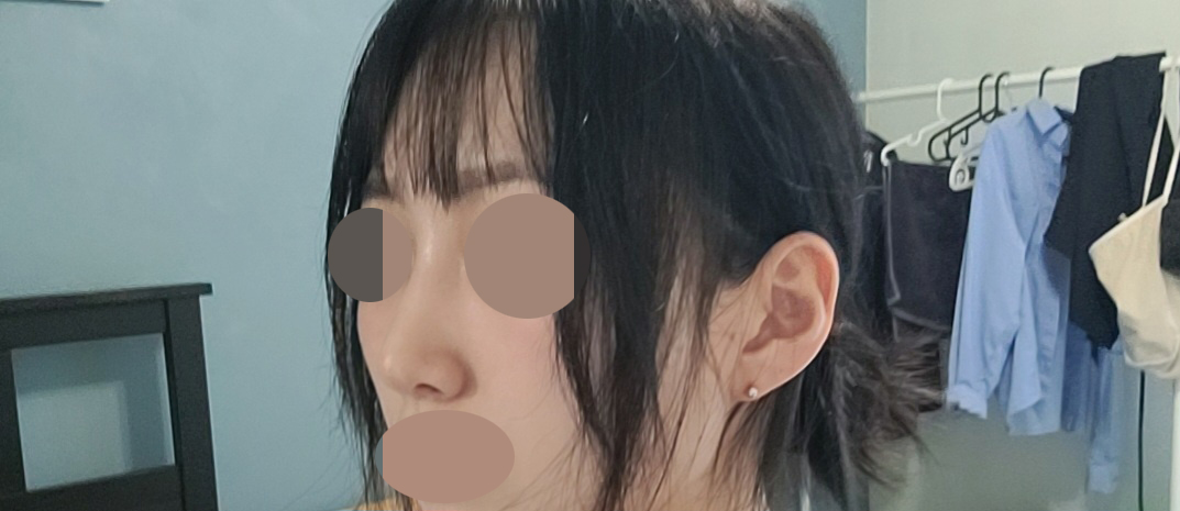 수술후기이미지