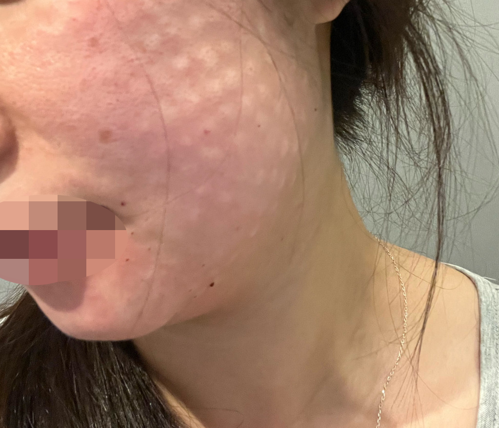 수술후기이미지