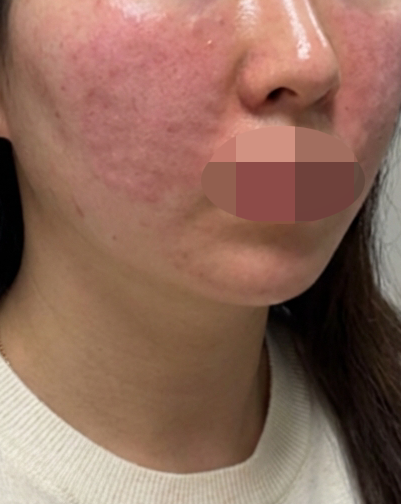 수술후기이미지