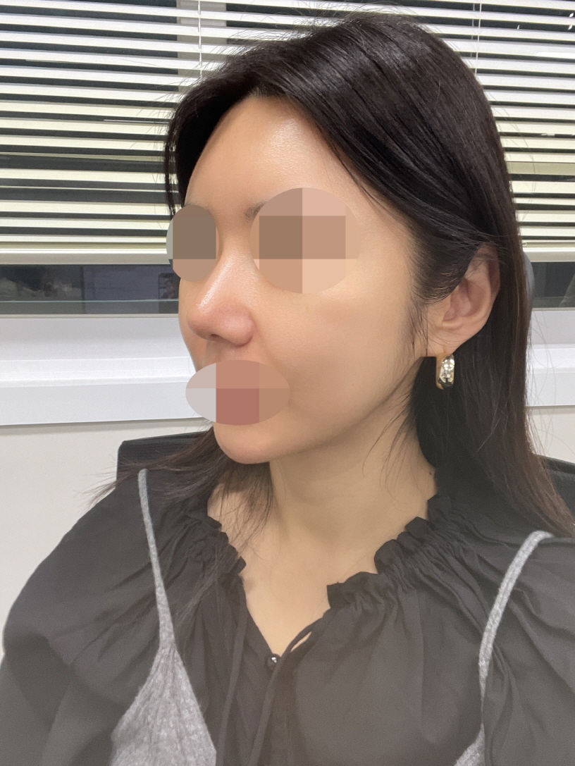 수술후기이미지