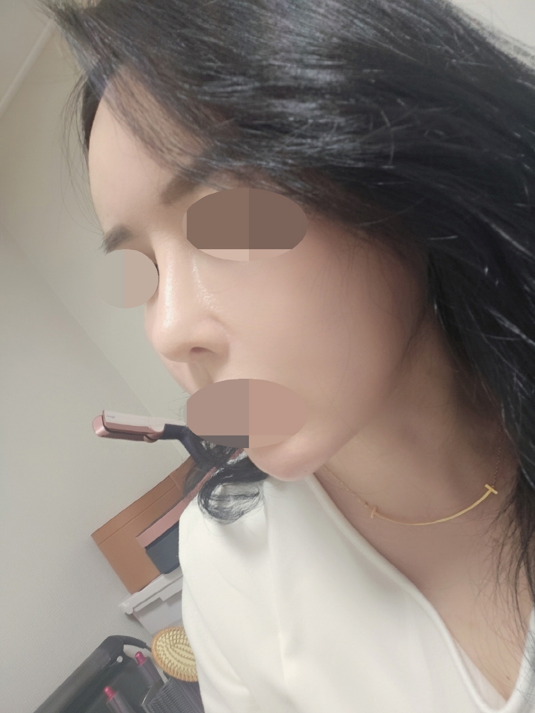 수술후기이미지