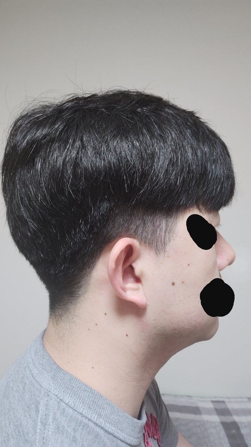 수술후기이미지