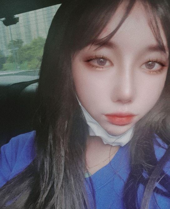 수술후기이미지