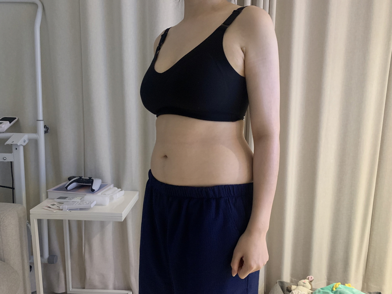 수술후기이미지