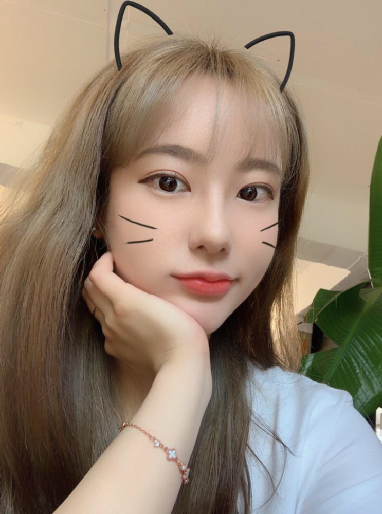 수술후기이미지