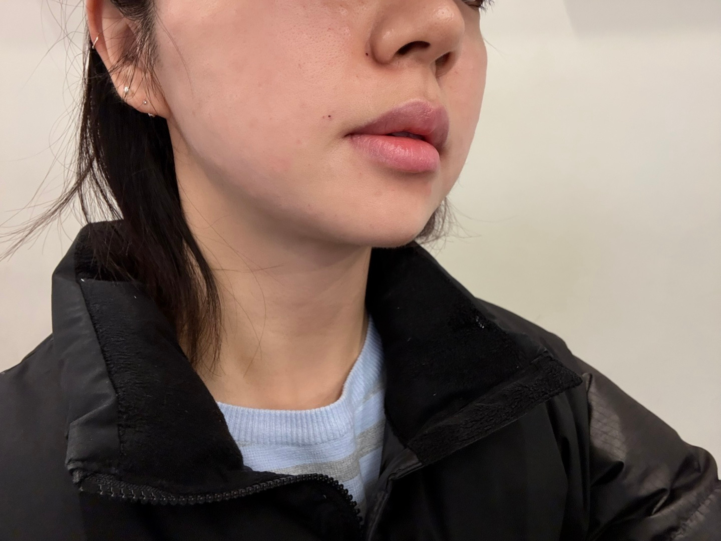 수술후기이미지