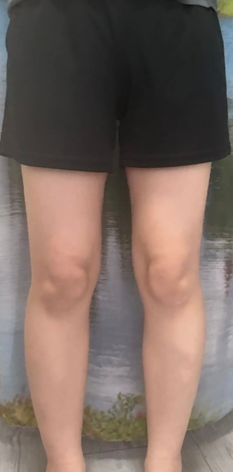수술후기이미지