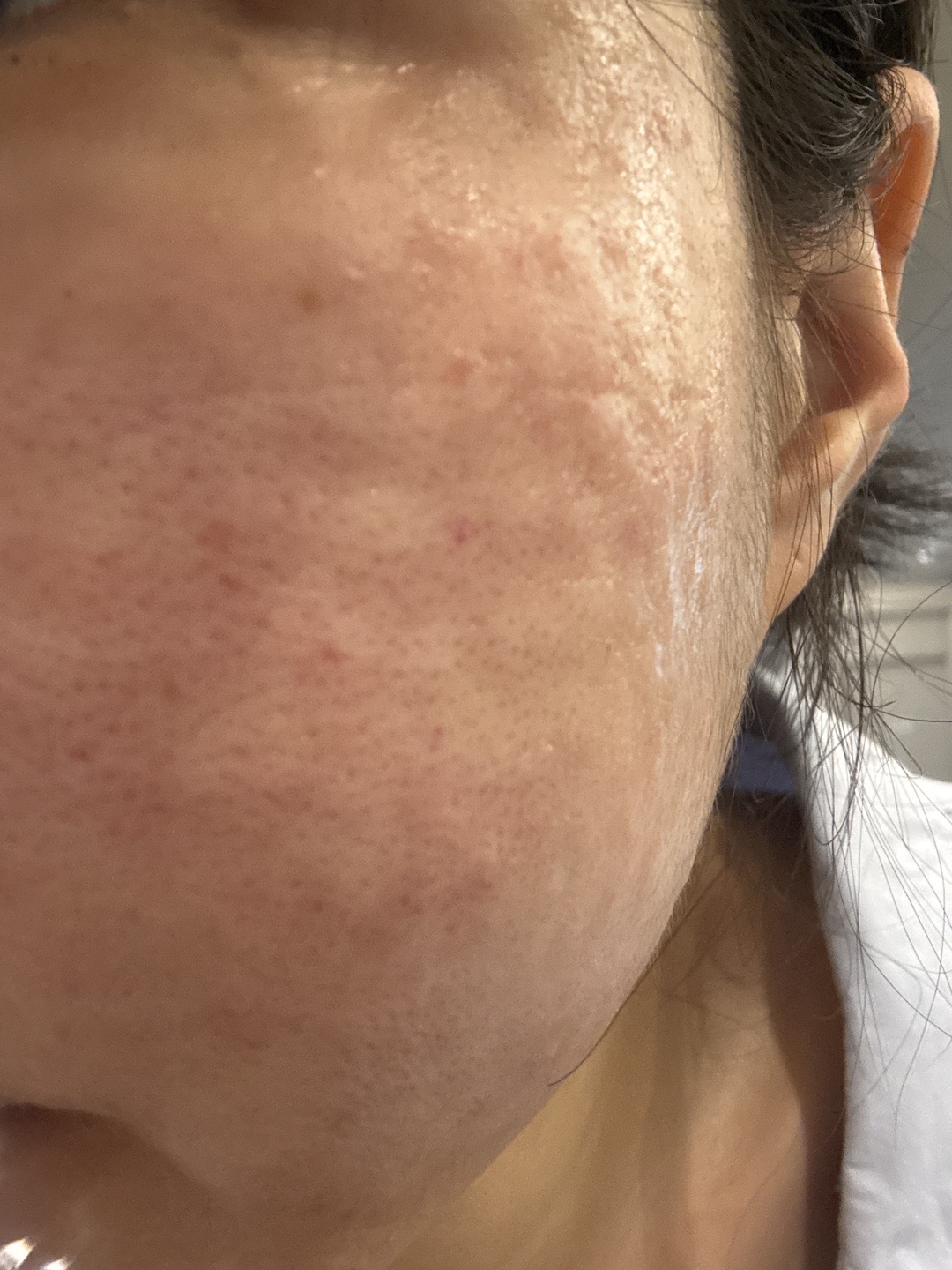 수술후기이미지