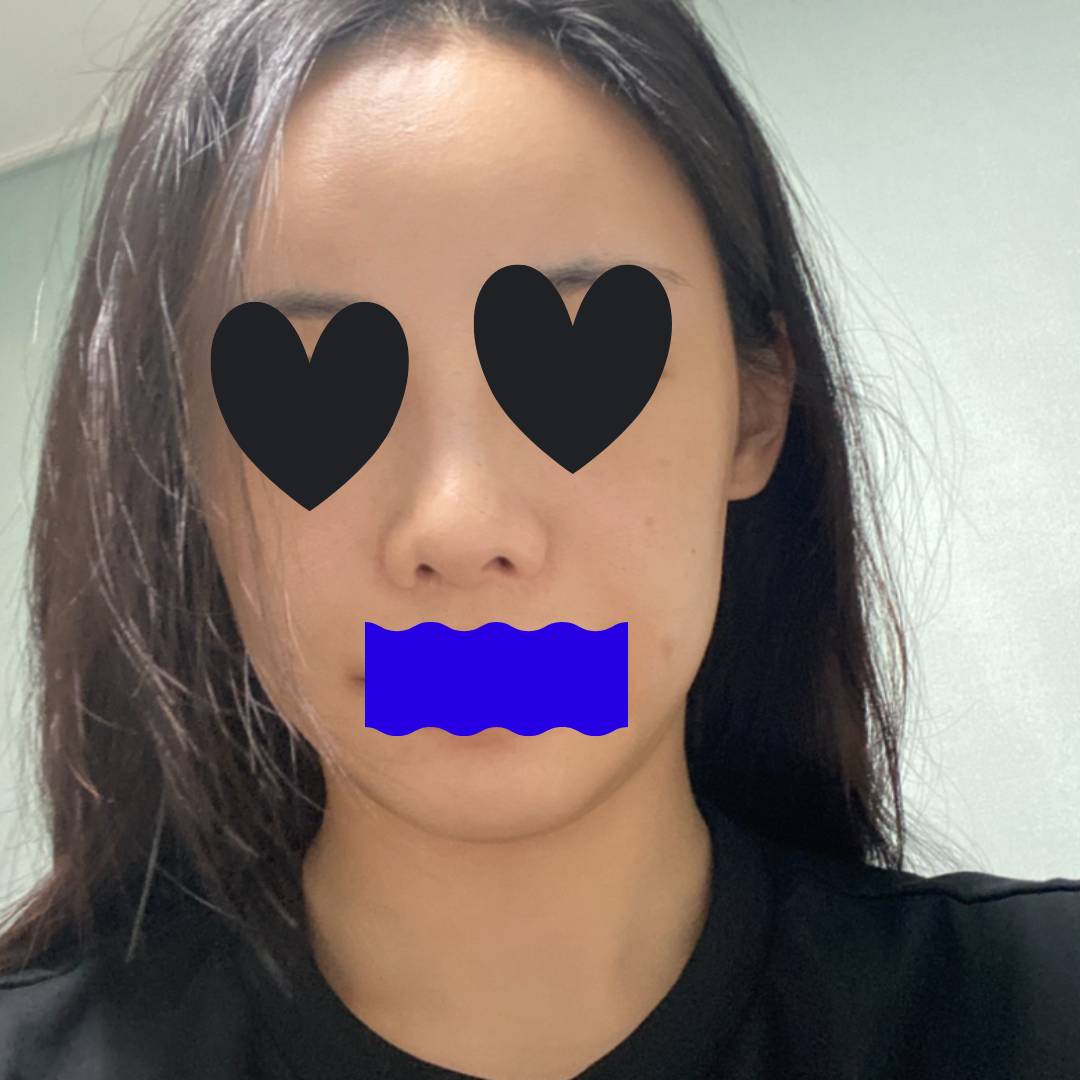 수술후기이미지