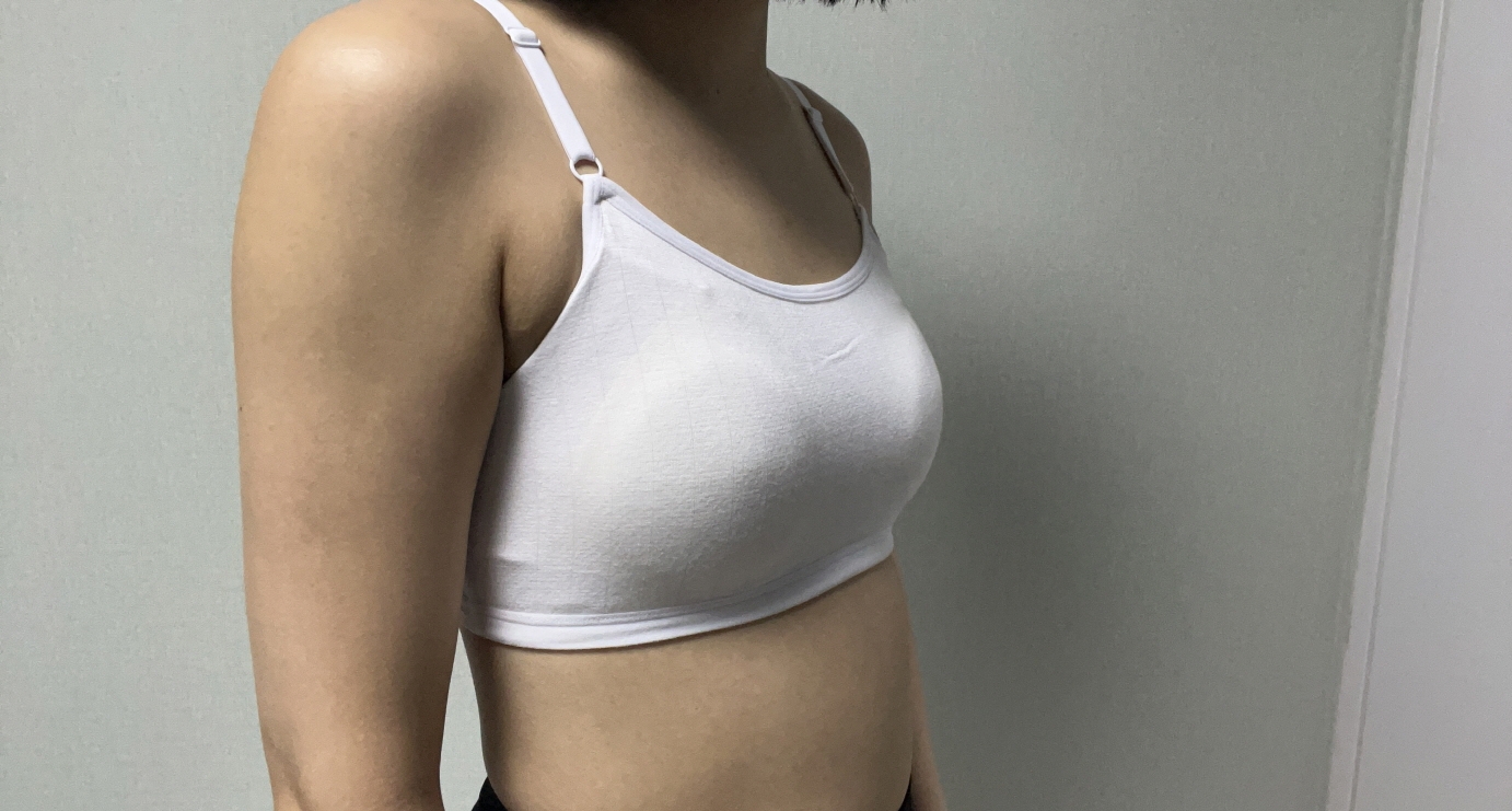 수술후기이미지