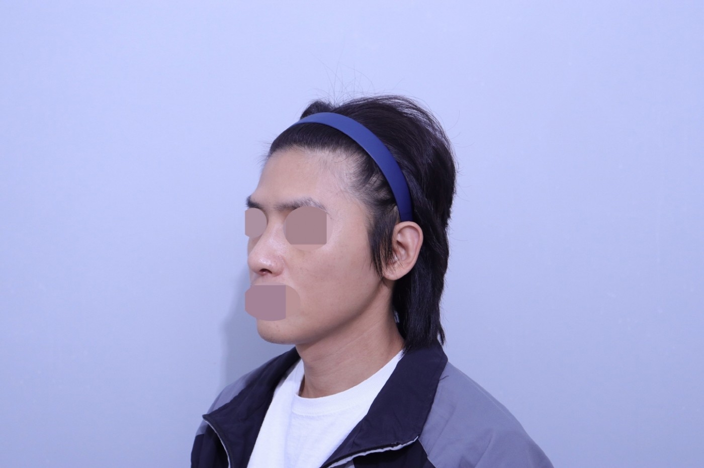 수술후기이미지