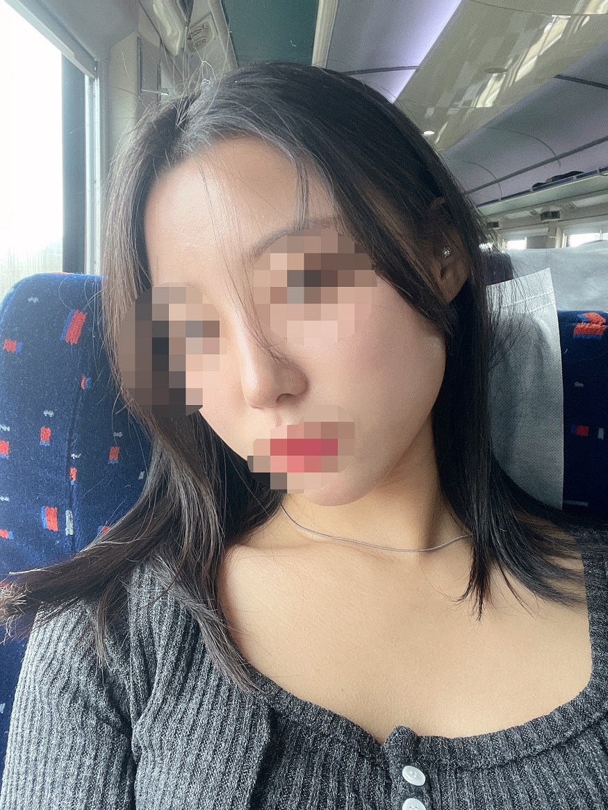 수술후기이미지