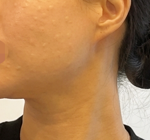 수술후기이미지