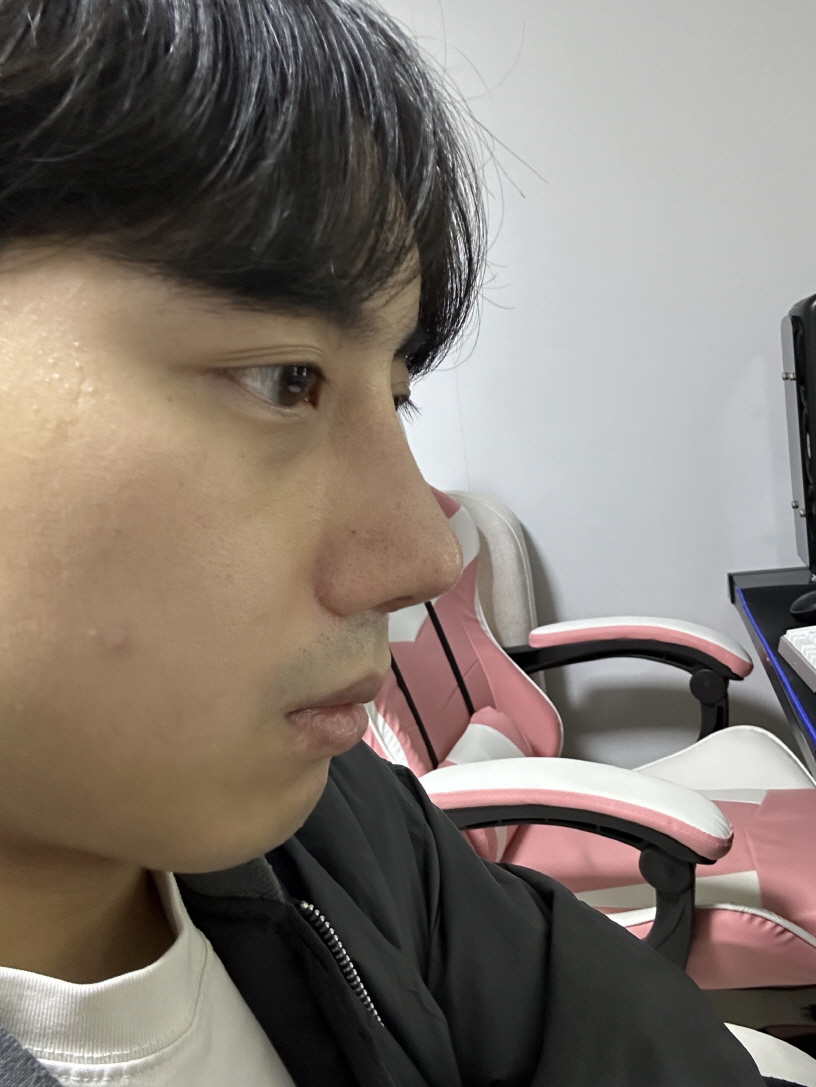 수술후기이미지