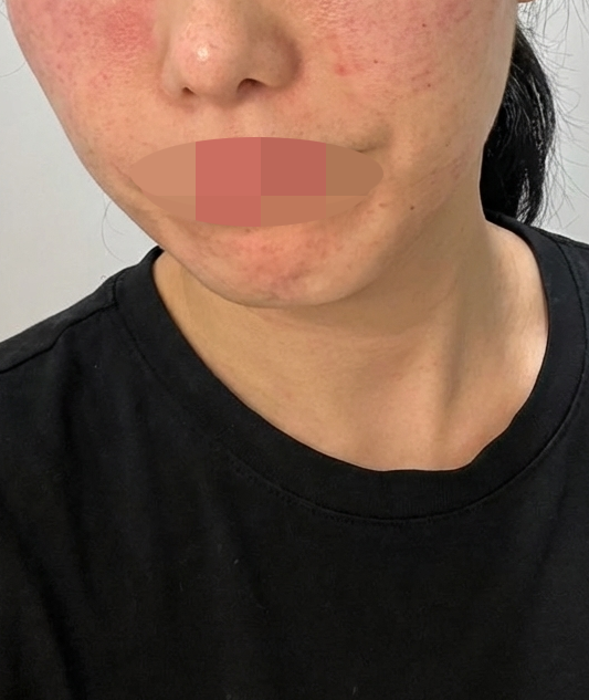 수술후기이미지