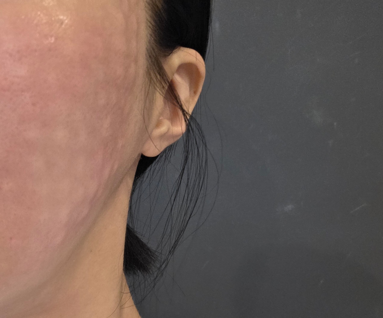 수술후기이미지