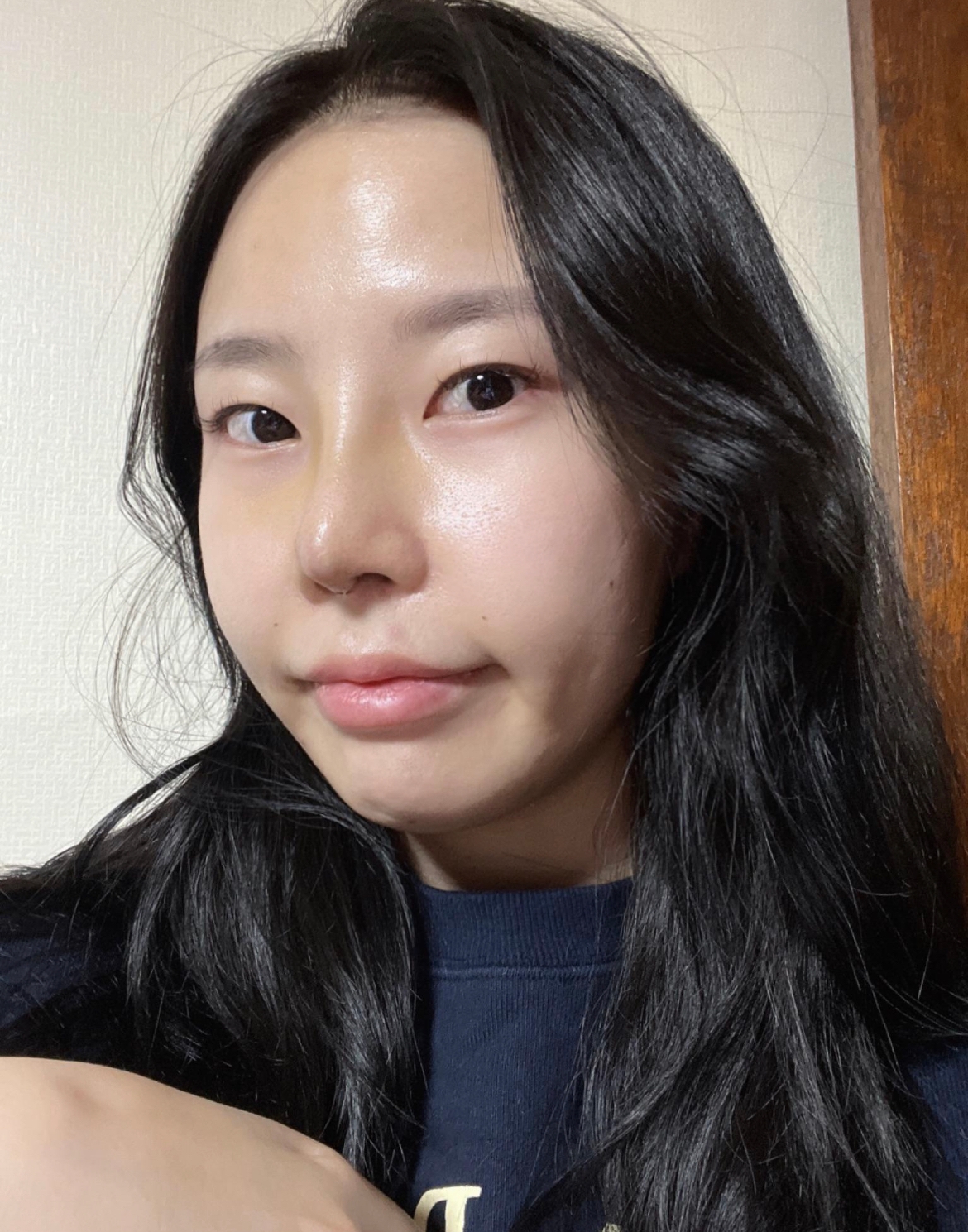 수술후기이미지