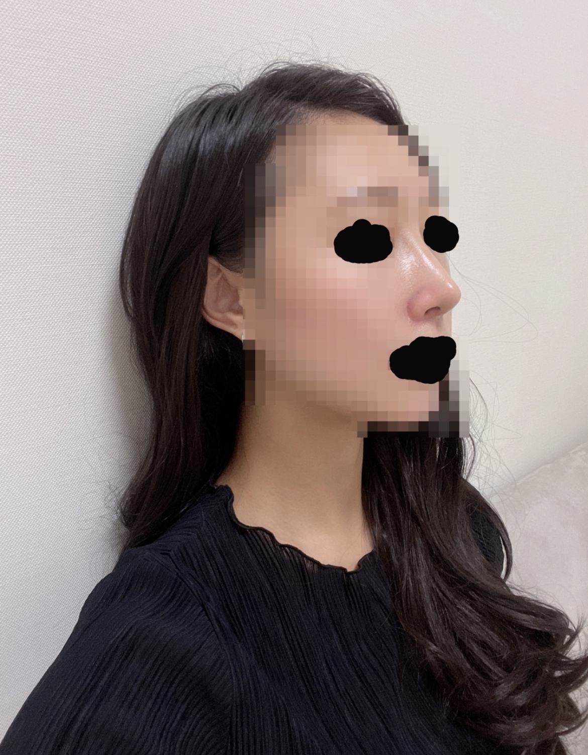 수술후기이미지