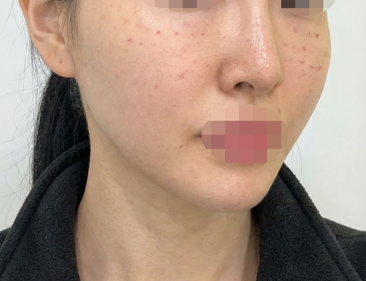 수술후기이미지