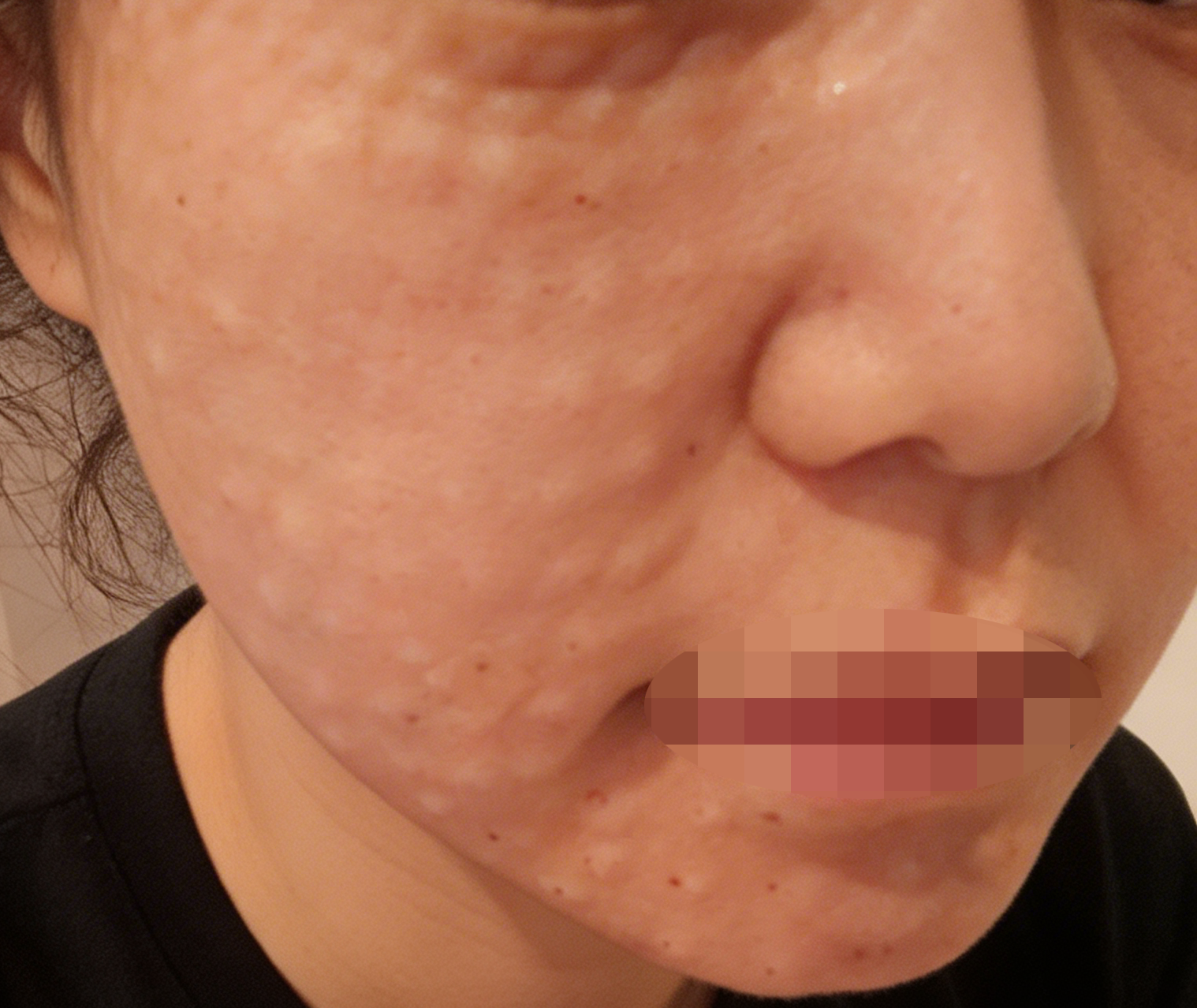 수술후기이미지