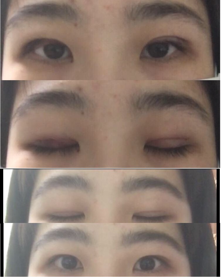 수술후기이미지