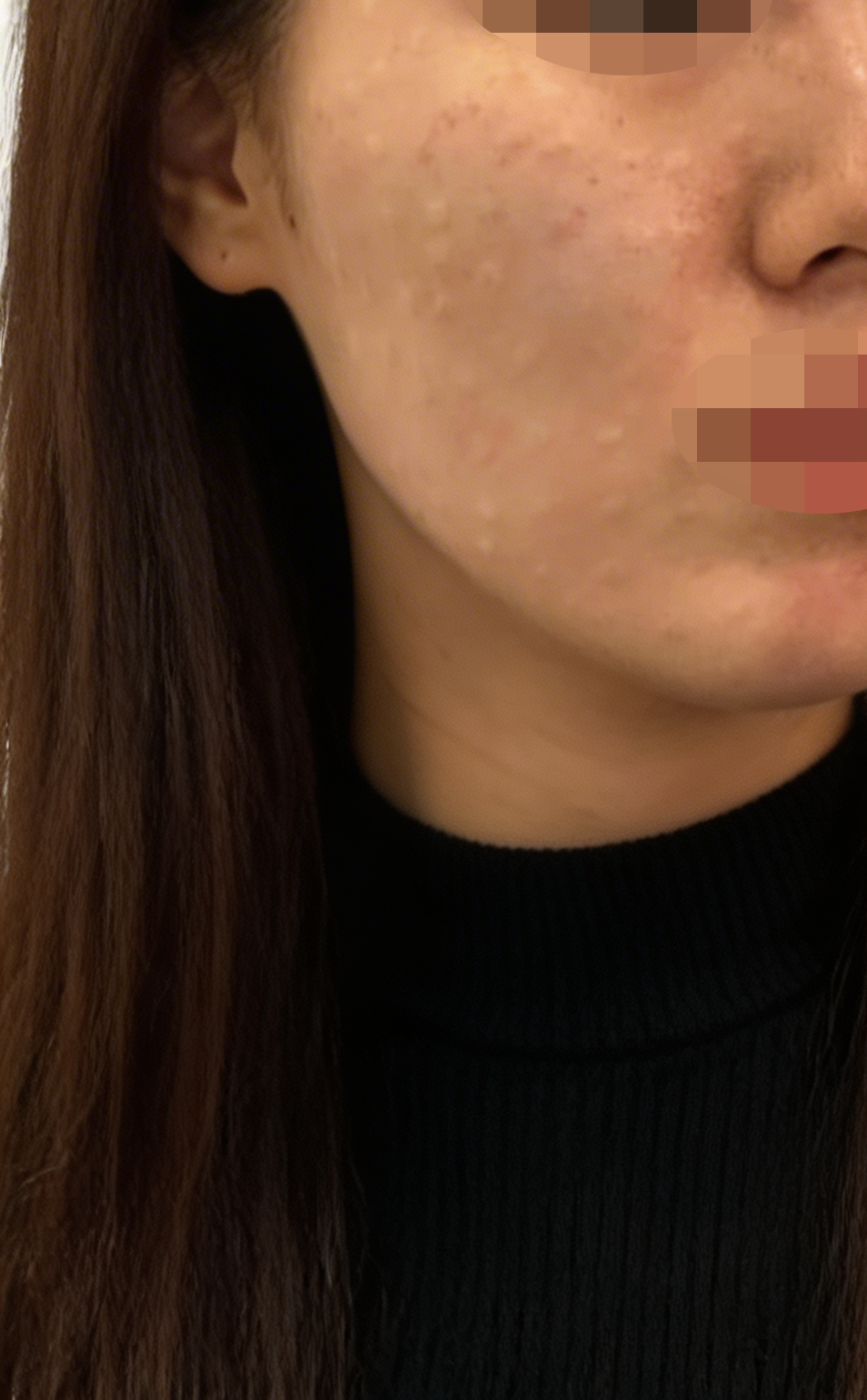 수술후기이미지