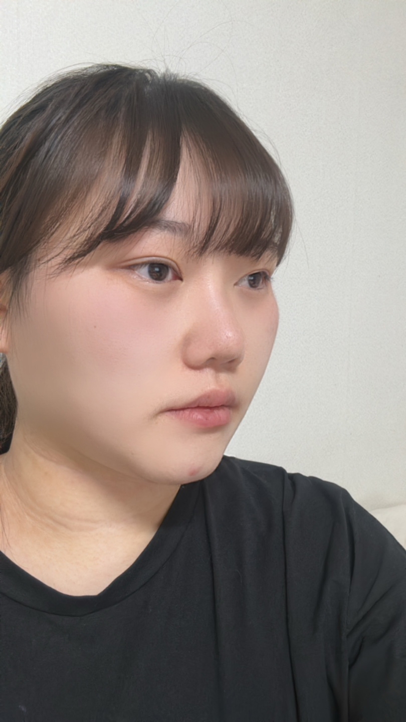 수술후기이미지