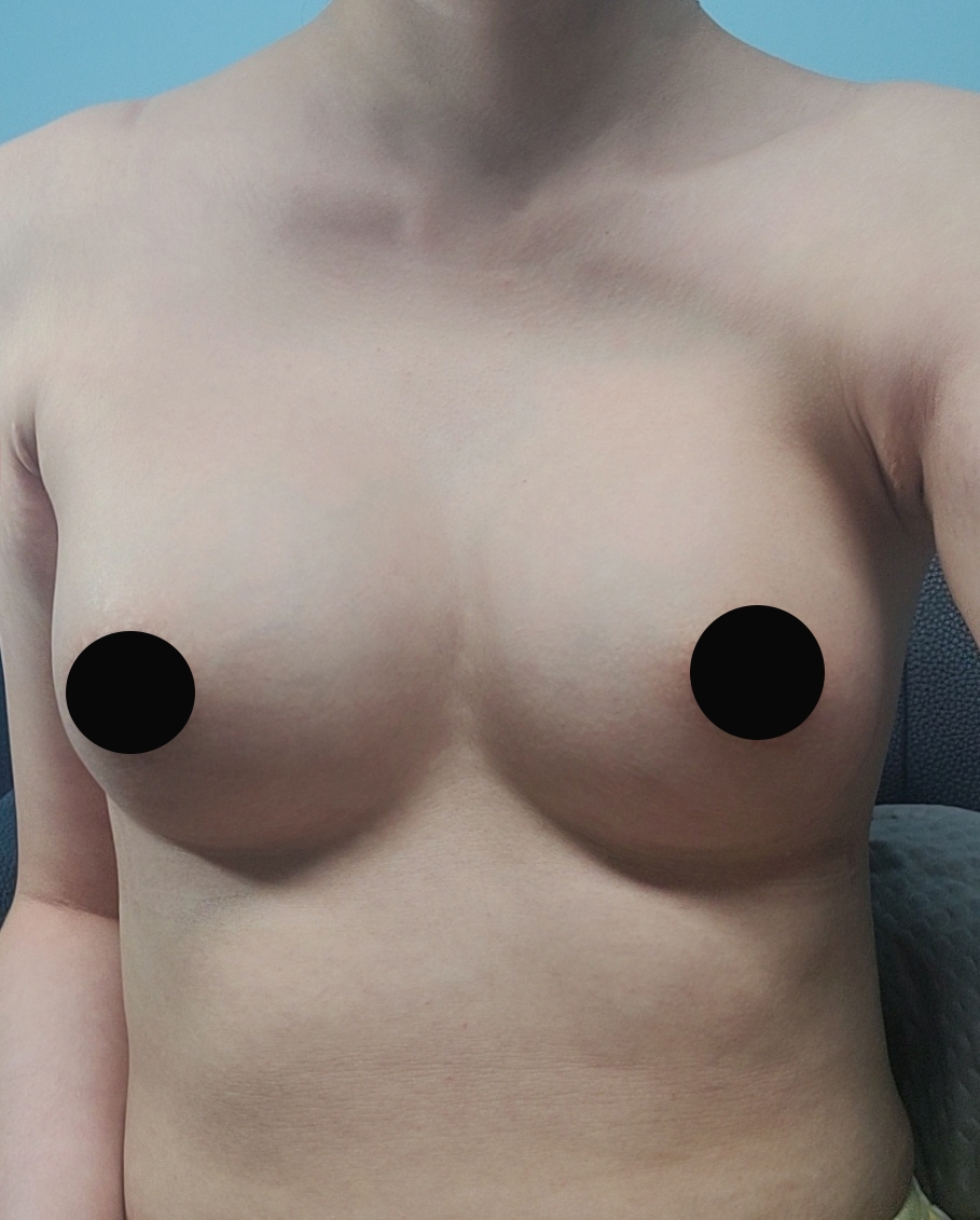 수술후기이미지