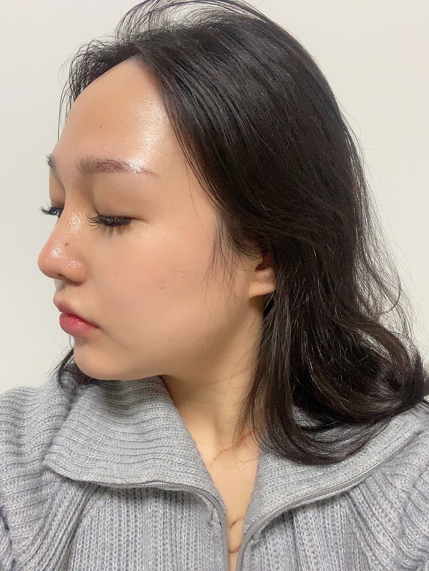 수술후기이미지