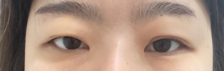 수술후기이미지