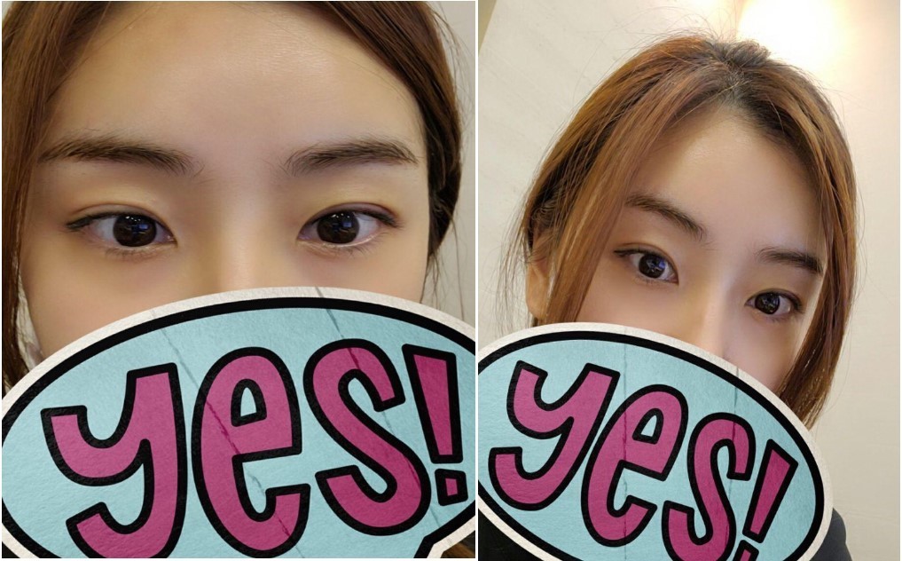 수술후기이미지