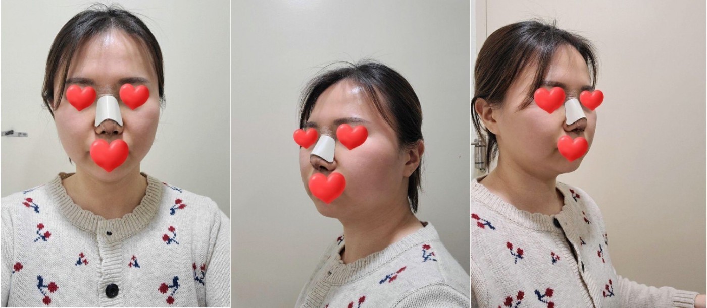 수술후기이미지