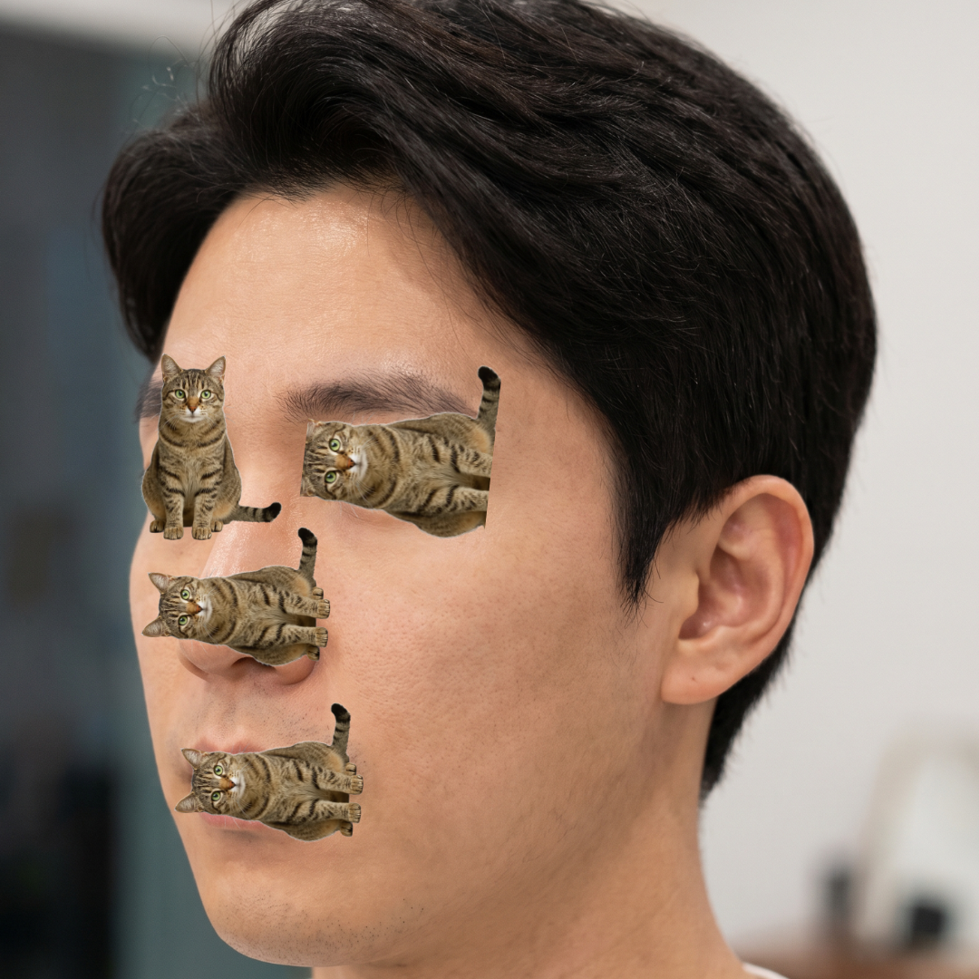 수술후기이미지