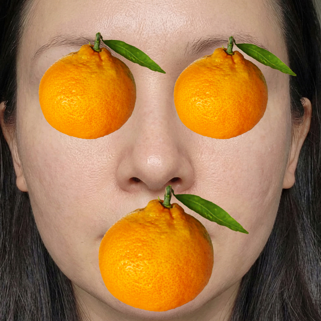 수술후기이미지