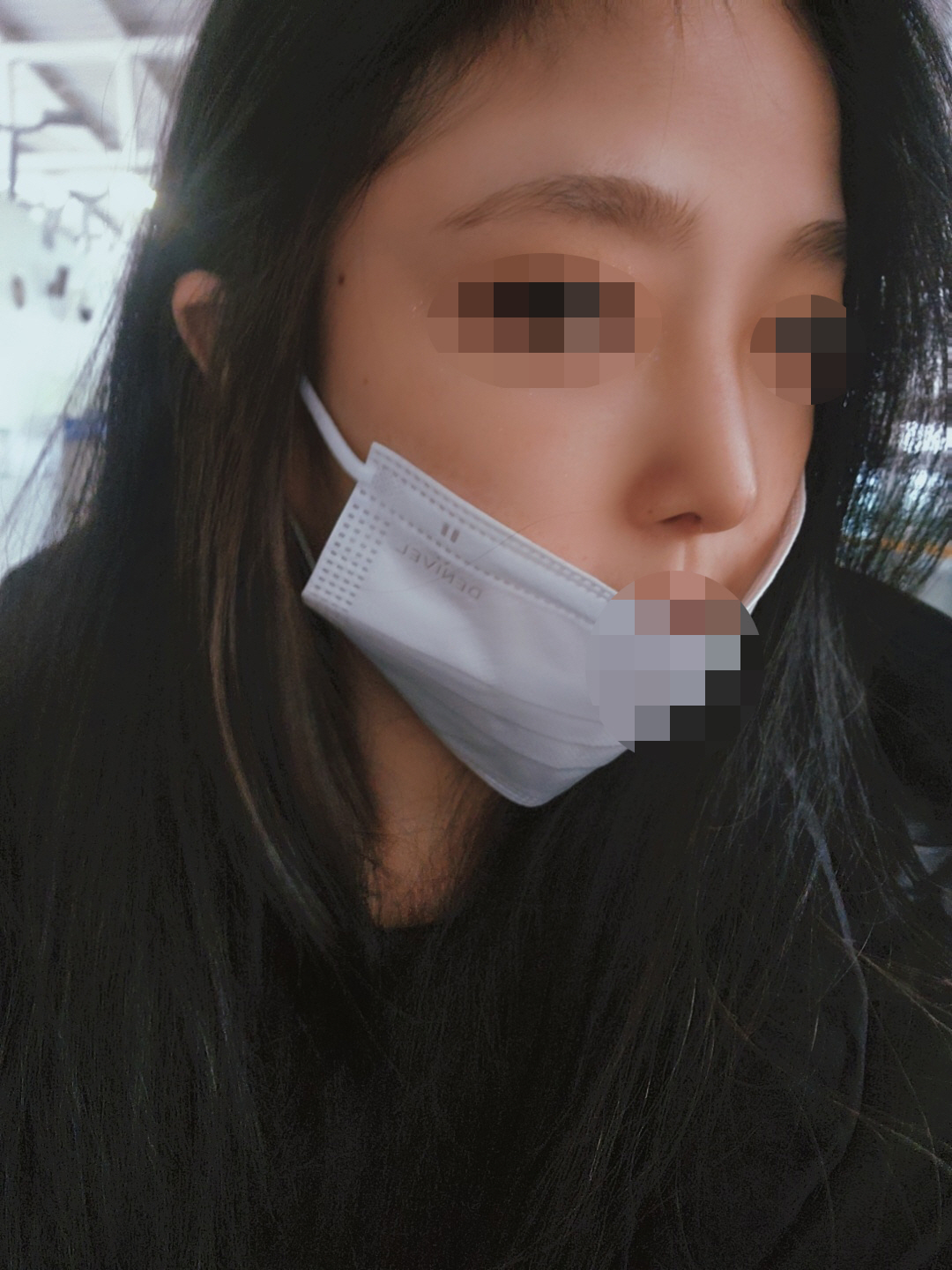 수술후기이미지