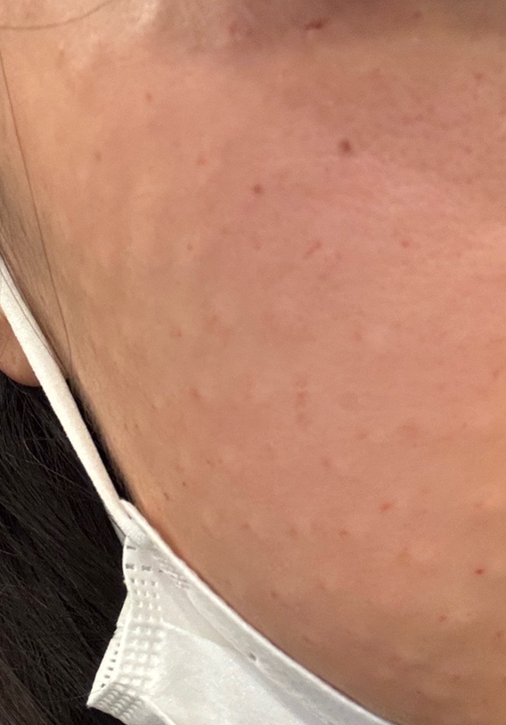 수술후기이미지