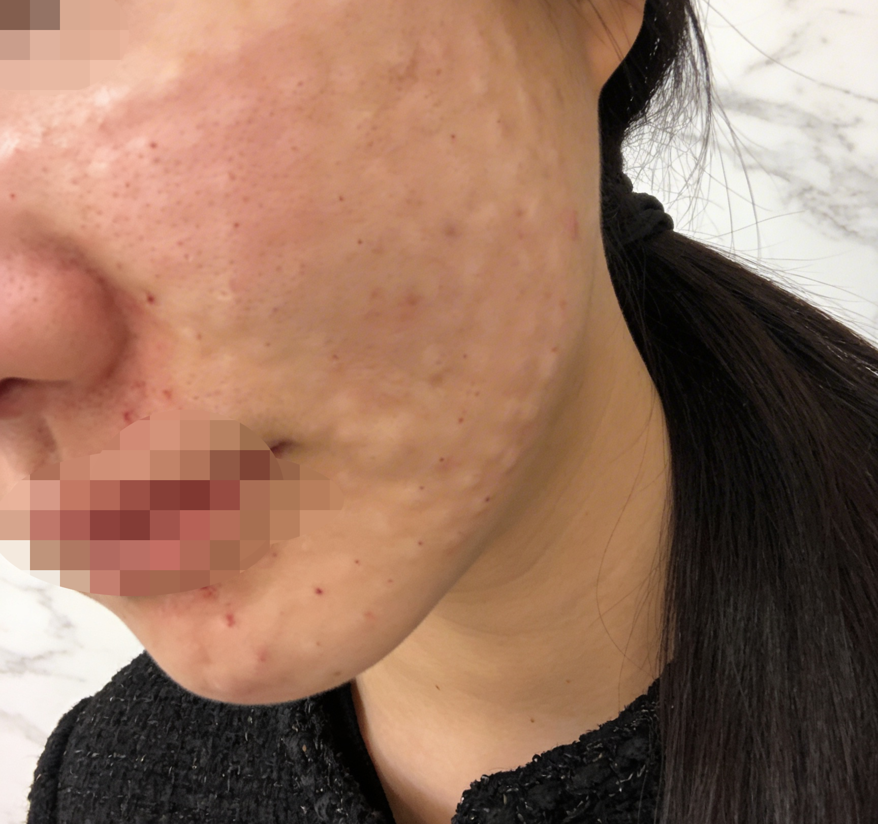 수술후기이미지