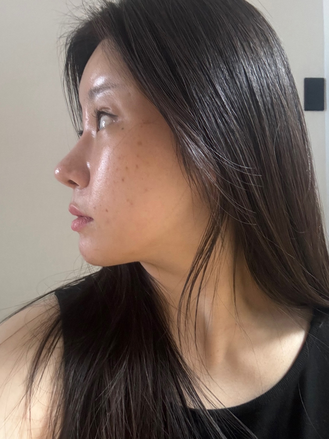 수술후기이미지