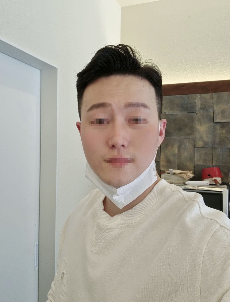 수술후기이미지