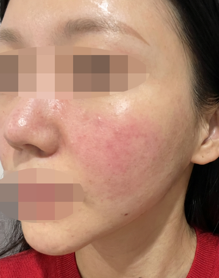 수술후기이미지