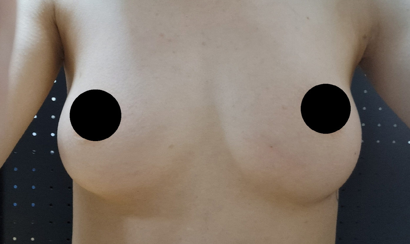 수술후기이미지