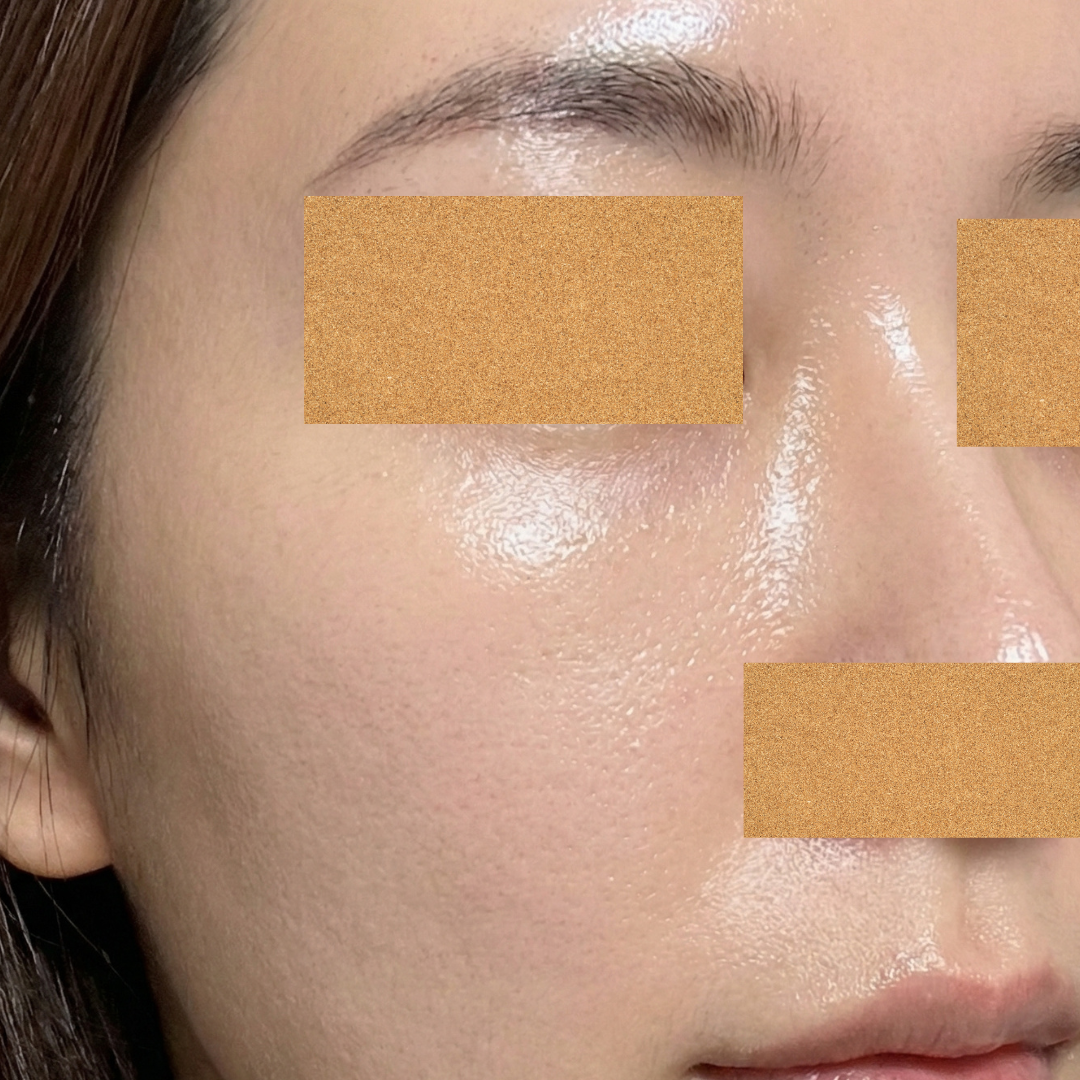 수술후기이미지