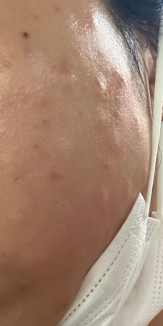 수술후기이미지