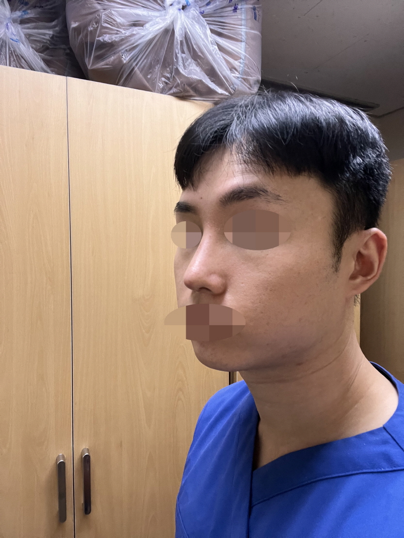 수술후기이미지