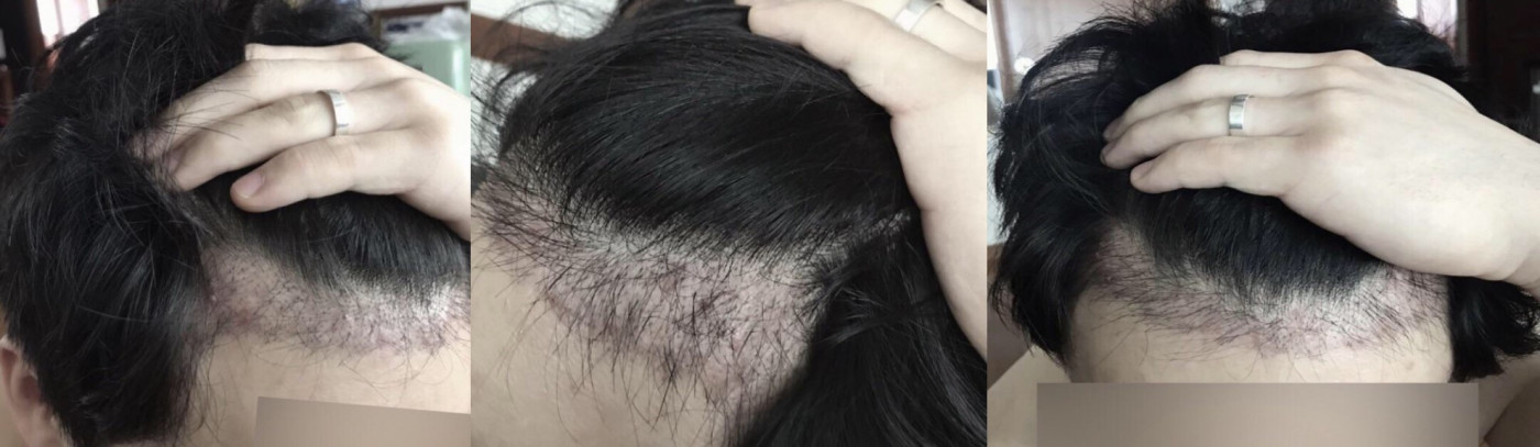 수술후기이미지