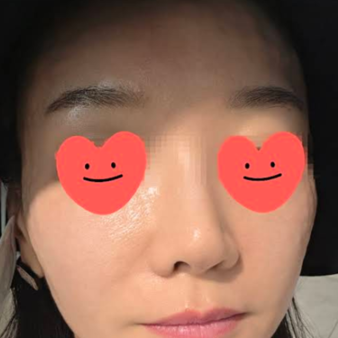수술후기이미지