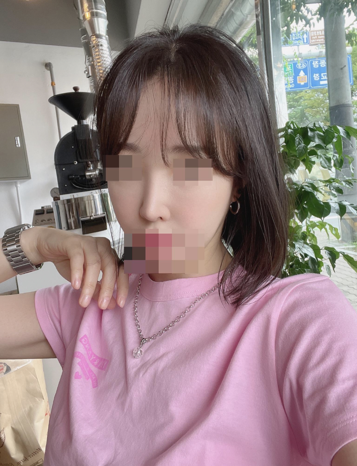 수술후기이미지