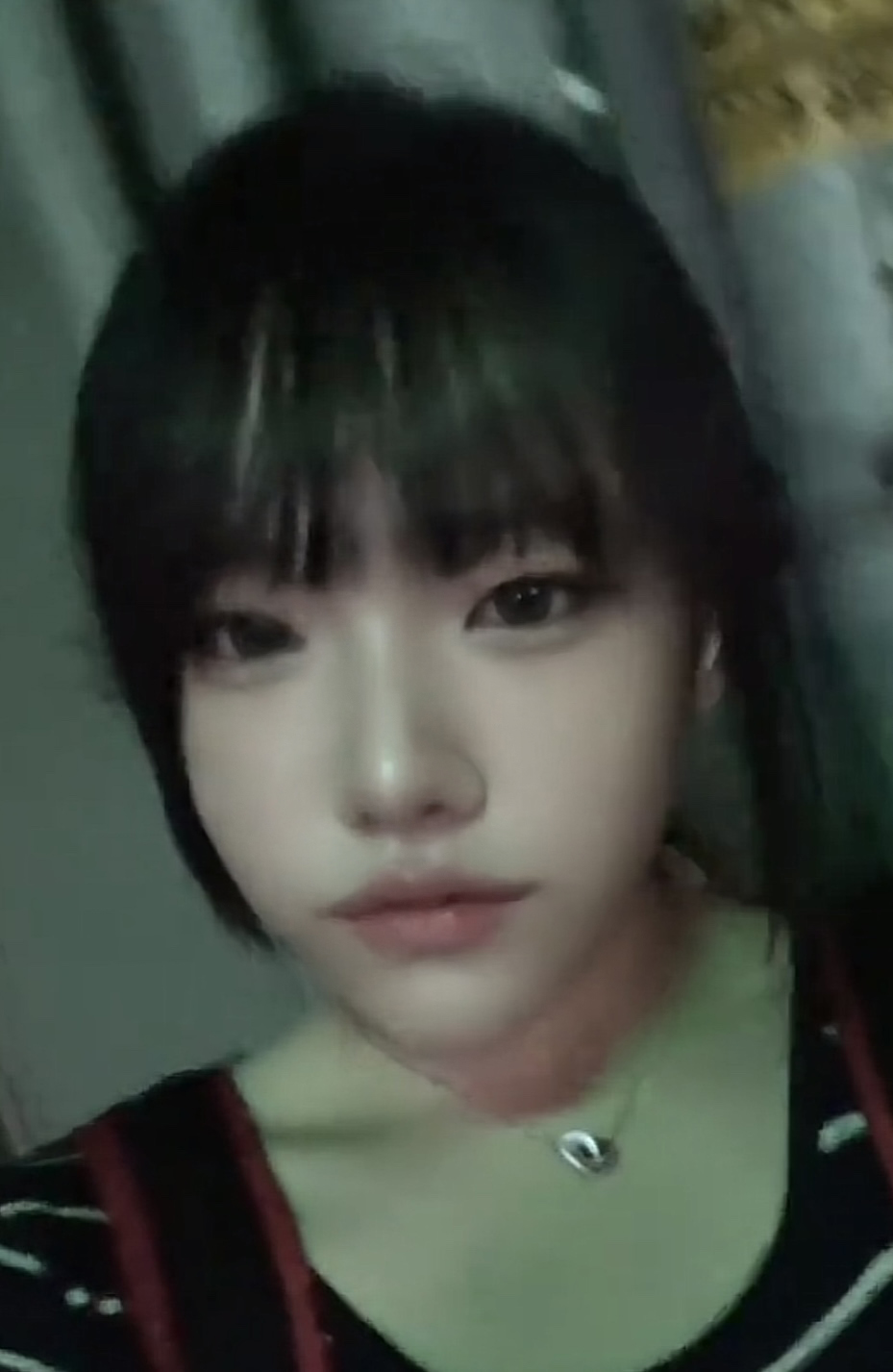 수술후기이미지