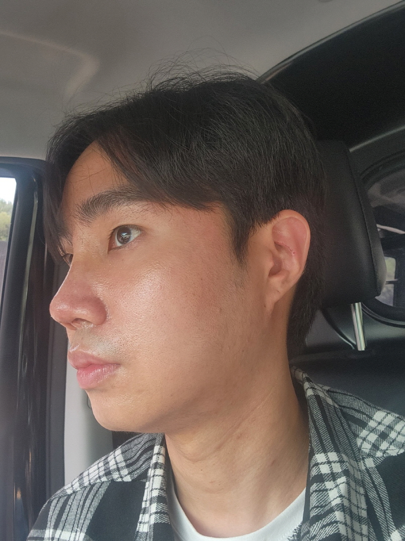 수술후기이미지